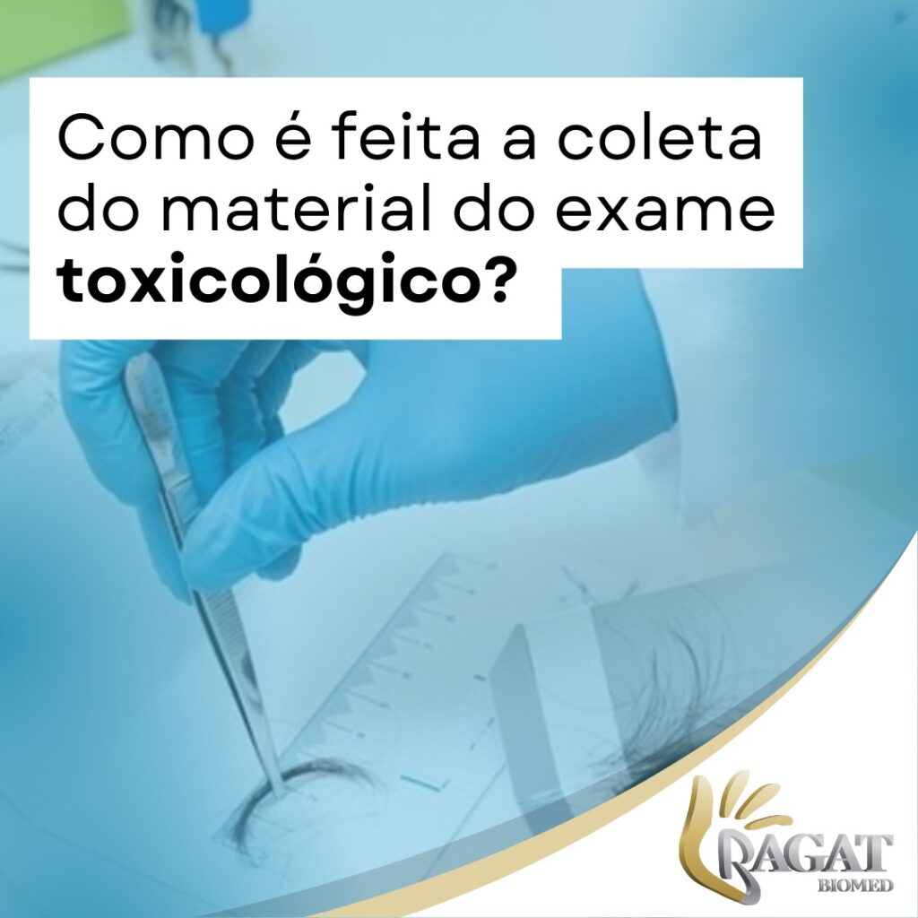 Coleta do Material para o Exame Toxicológico